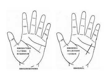 健康線,健康狀況,手相分析