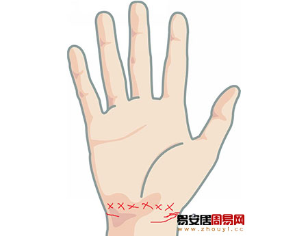 手腕線在手腕動脈處紋路成交叉狀