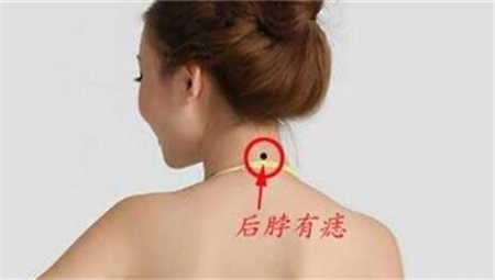 痣相看吉凶,凶痣介紹,痣相分析