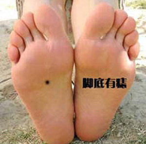 腳底有痣,痣相